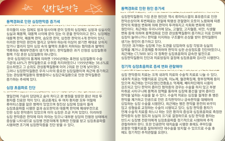 심장판막